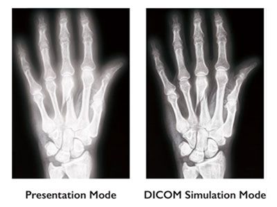 DICOM